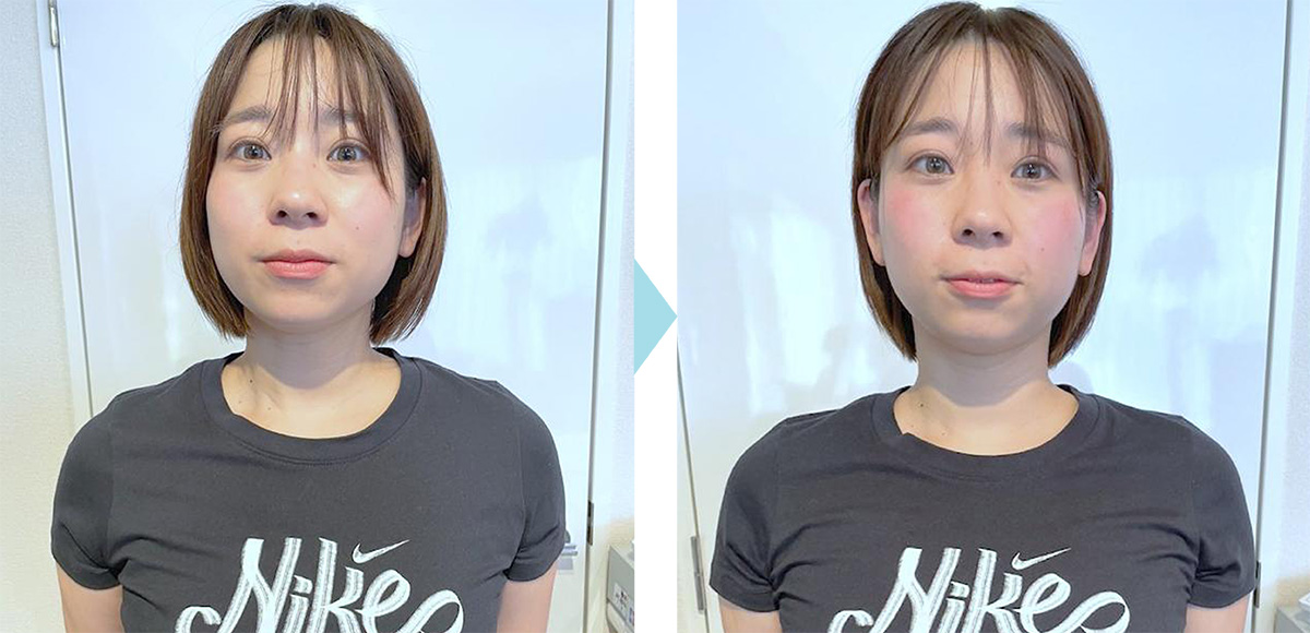 Before After